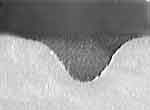 Фото 7. Пулевой канал от попадания шариком через два слоя ткани.